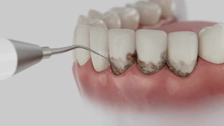 Reliable Tooth Extraction contractor in Hurricane, WV by Smile Center Dentistry